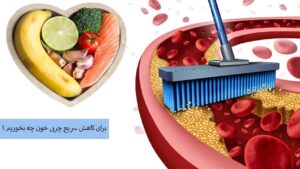 برای کاهش سریع چربی خون چه بخوریم؟