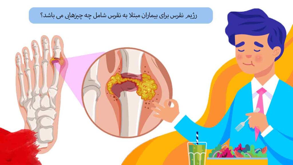 محدودیت های رژیم نقرس