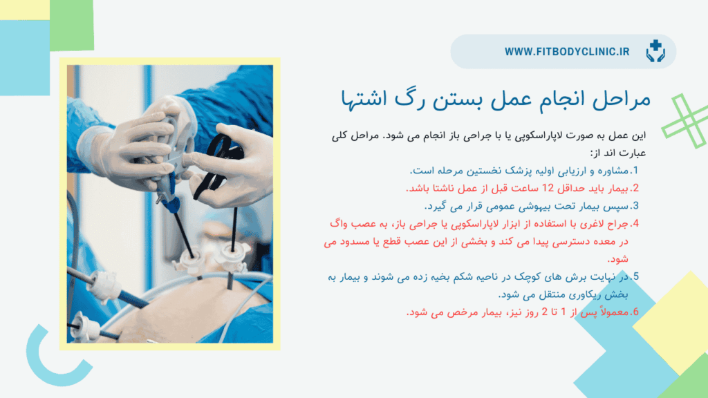 مراحل انجام عمل بستن رگ اشتها 