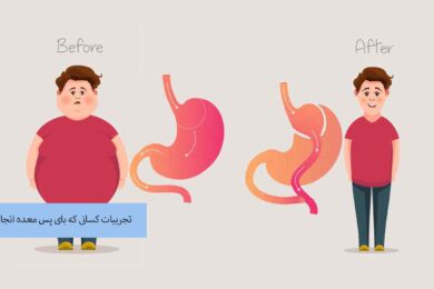 تجربیات کسانی که بای پس معده انجام داده اند