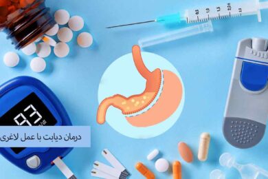 درمان دیابت با عمل لاغری