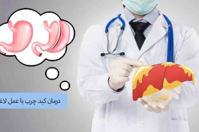 درمان کبد چرب با عمل لاغری