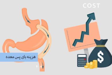 هزینه بای پس معده